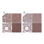 Atlas Antibodies Anti-PFDN6 Antibody