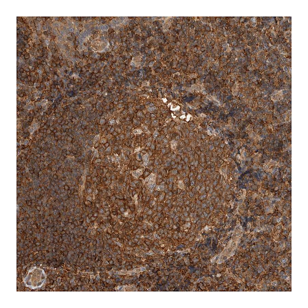 Atlas Antibodies Anti-PFDN4 Antibody