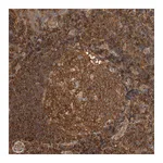 Atlas Antibodies Anti-PFDN4 Antibody