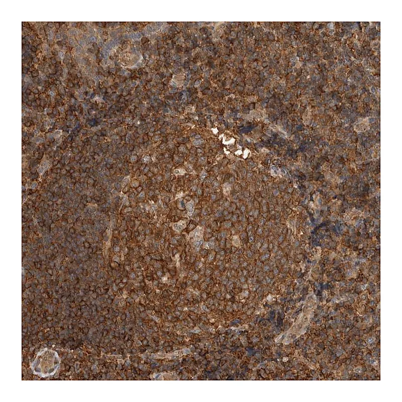 Atlas Antibodies Anti-PFDN4 Antibody