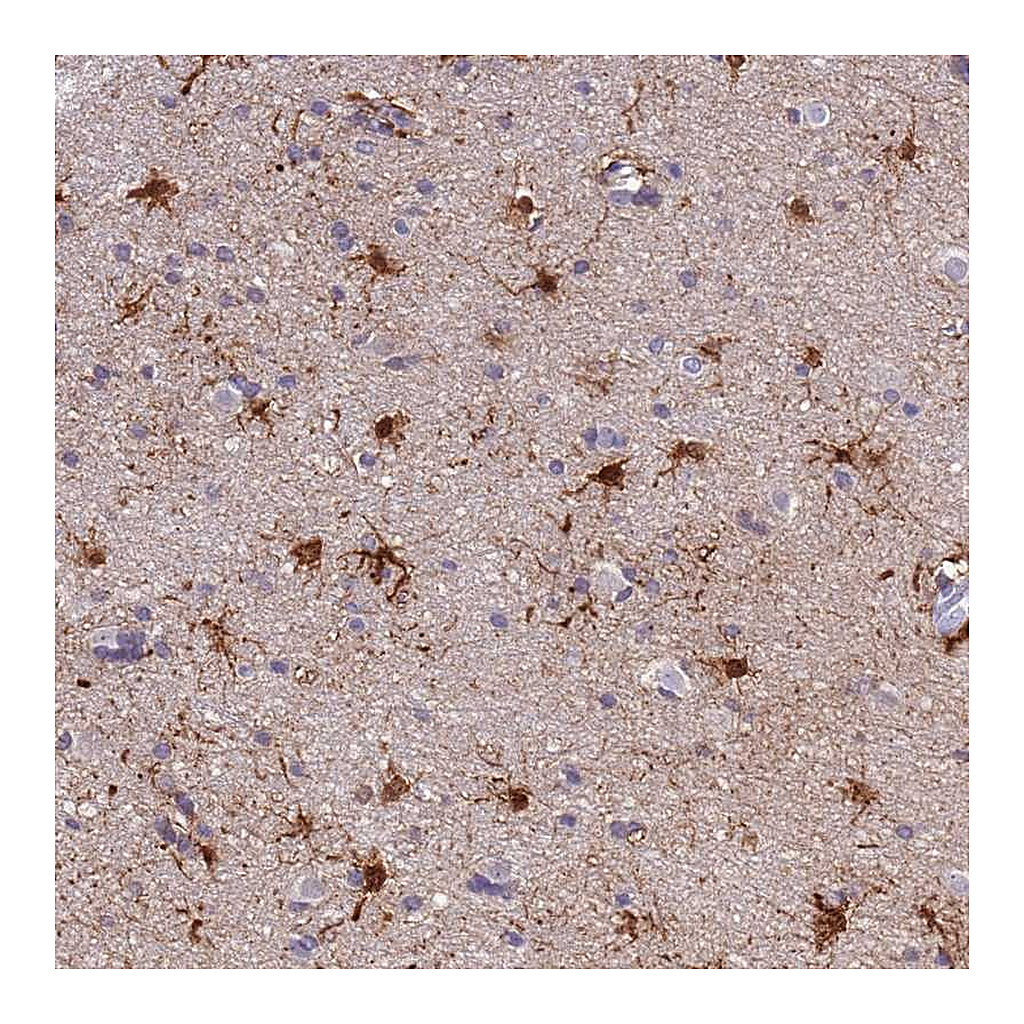 Atlas Antibodies Anti-PFKFB2 Antibody