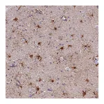 Atlas Antibodies Anti-PFKFB2 Antibody