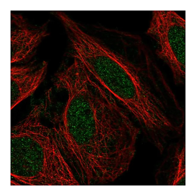 Atlas Antibodies Anti-PFKFB2 Antibody