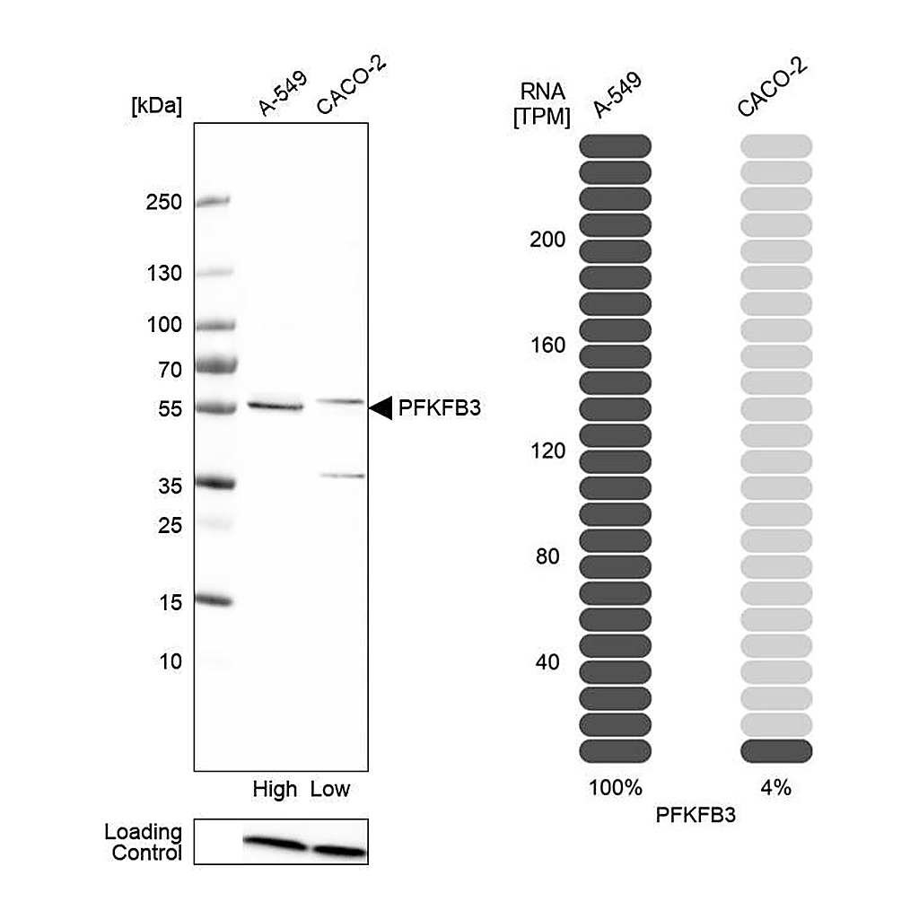 Atlas Antibodies Anti-PFKFB3 Antibody