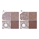 Atlas Antibodies Anti-PFDN6 Antibody