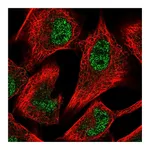 Atlas Antibodies Anti-PFKFB3 Antibody