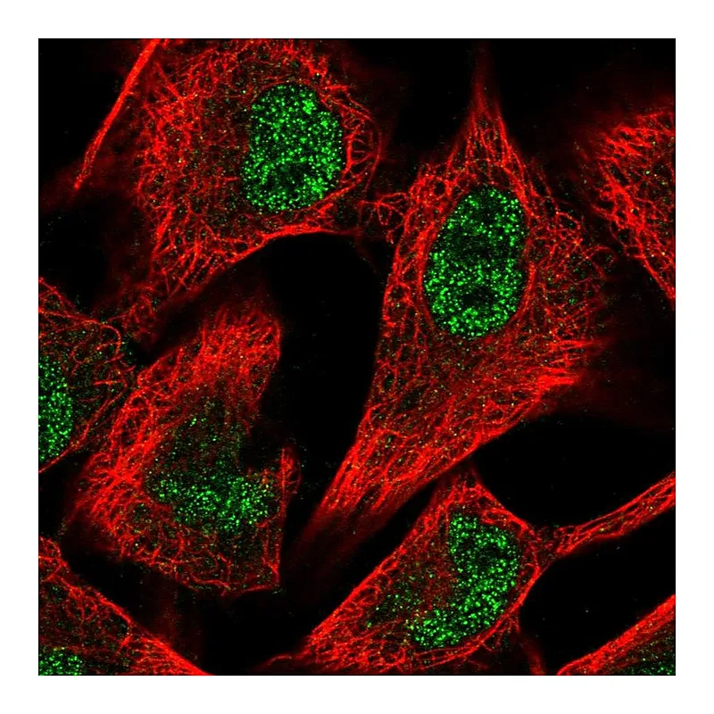 Atlas Antibodies Anti-PFKFB3 Antibody