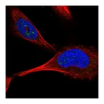 Atlas Antibodies Anti-PFKFB4 Antibody