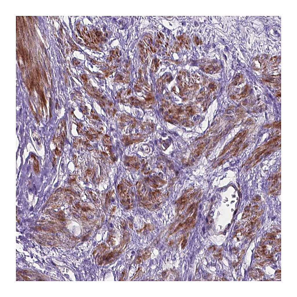 Atlas Antibodies Anti-PFKFB4 Antibody