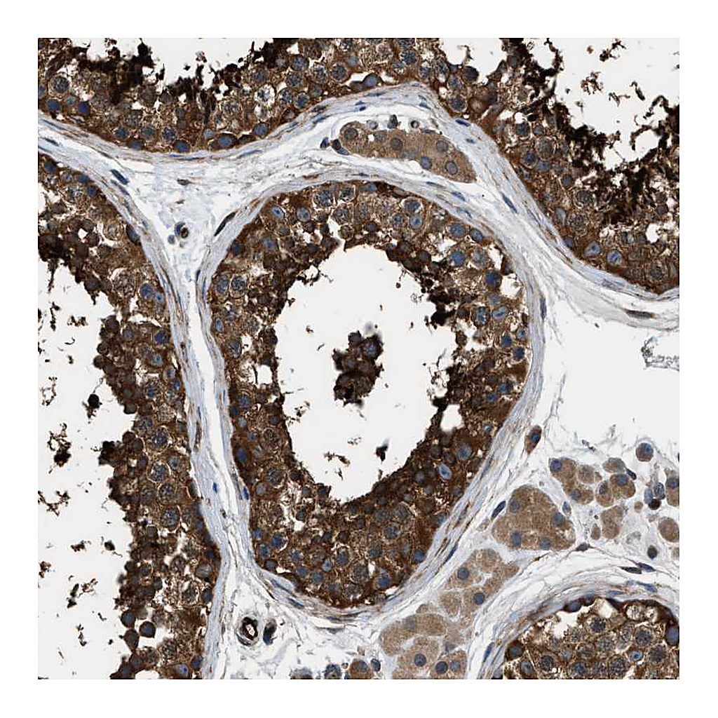 Atlas Antibodies Anti-PFKP Antibody