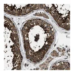 Atlas Antibodies Anti-PFKP Antibody