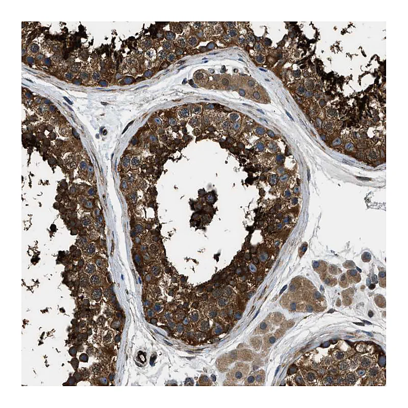Atlas Antibodies Anti-PFKP Antibody