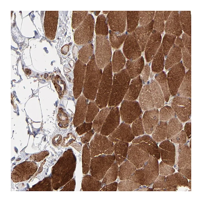 Atlas Antibodies Anti-PFKM Antibody