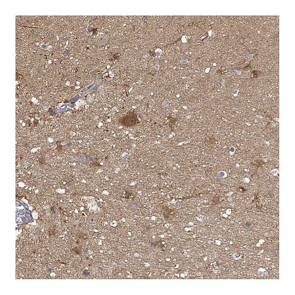 Atlas Antibodies Anti-PGAM1 Antibody