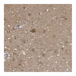 Atlas Antibodies Anti-PGAM1 Antibody