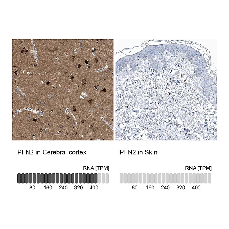 Atlas Antibodies Anti-PFN2 Antibody