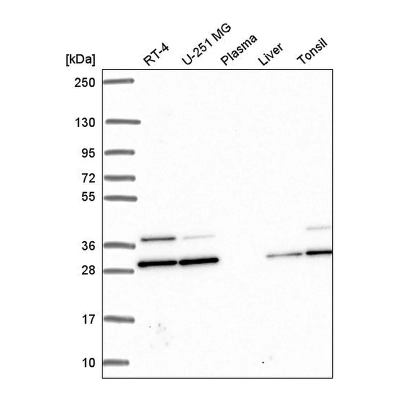 Atlas Antibodies Anti-PGAM1 Antibody