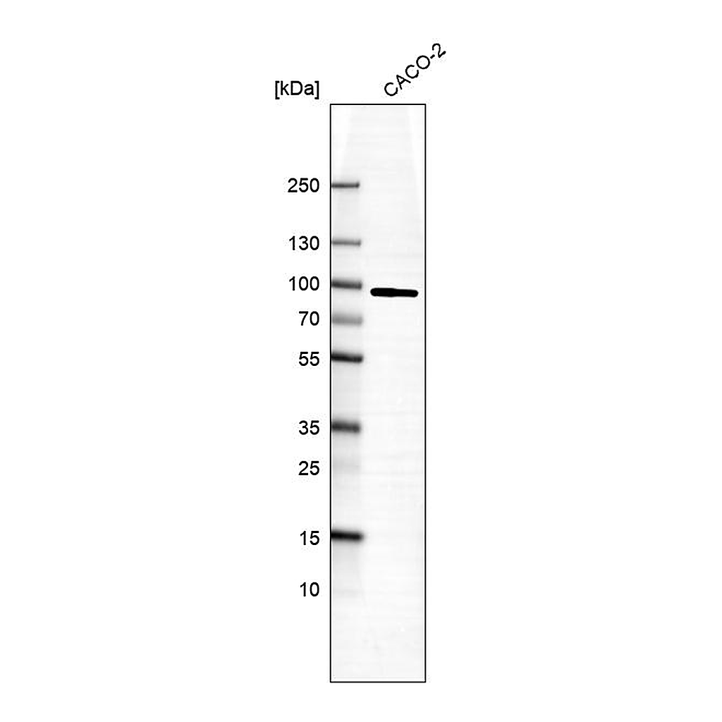 Atlas Antibodies Anti-PFKP Antibody