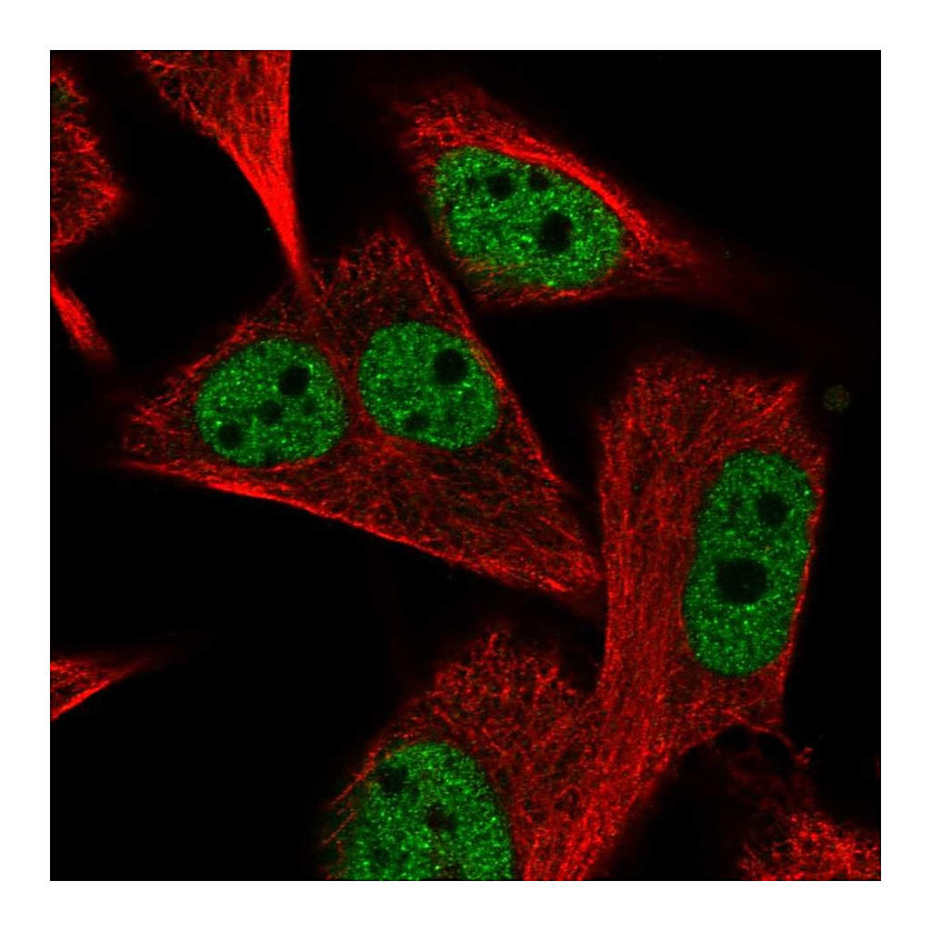 Atlas Antibodies Anti-PGAM2 Antibody