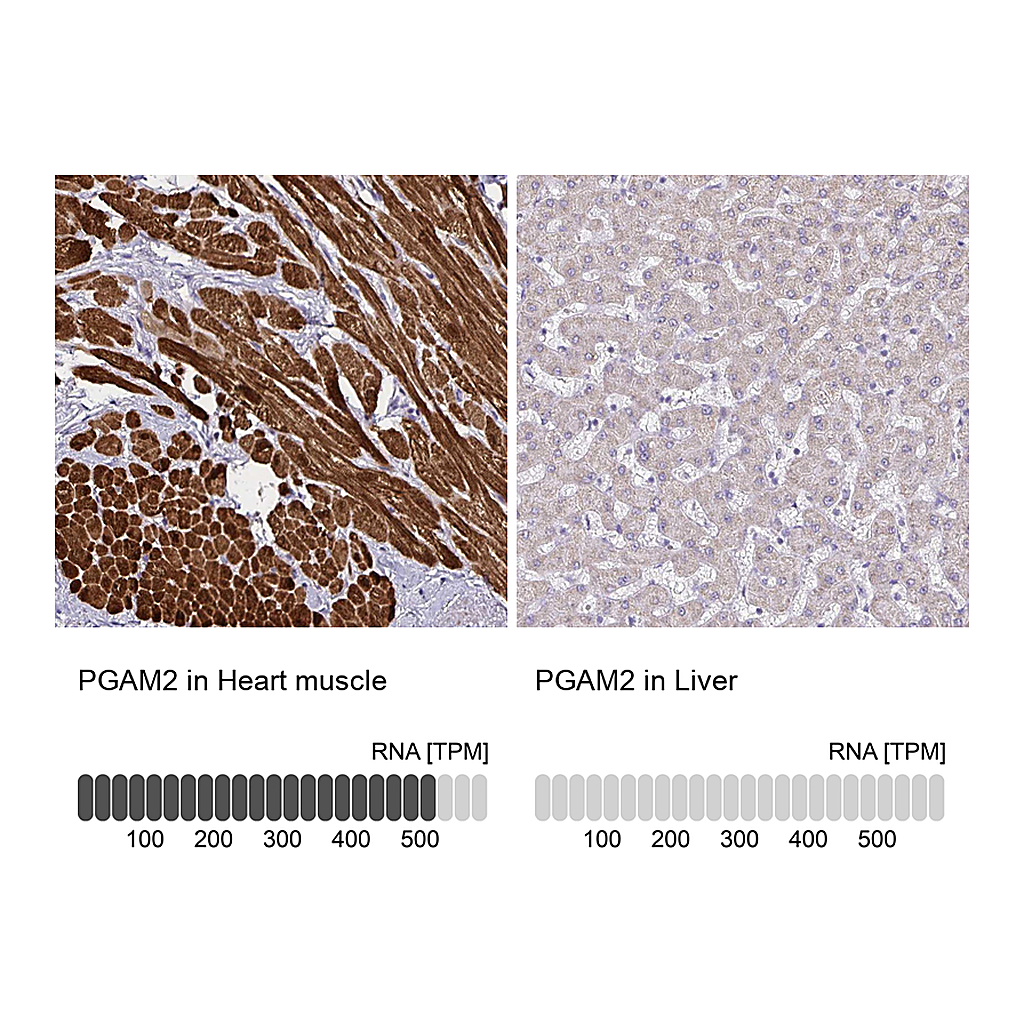 Atlas Antibodies Anti-PGAM2 Antibody