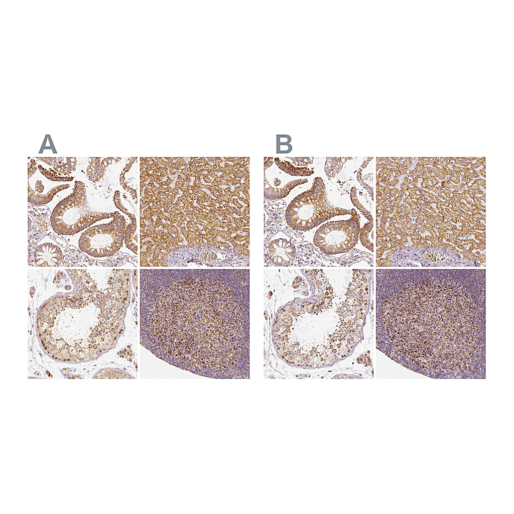Atlas Antibodies Anti-PGAM5 Antibody