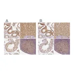 Atlas Antibodies Anti-PGAM5 Antibody