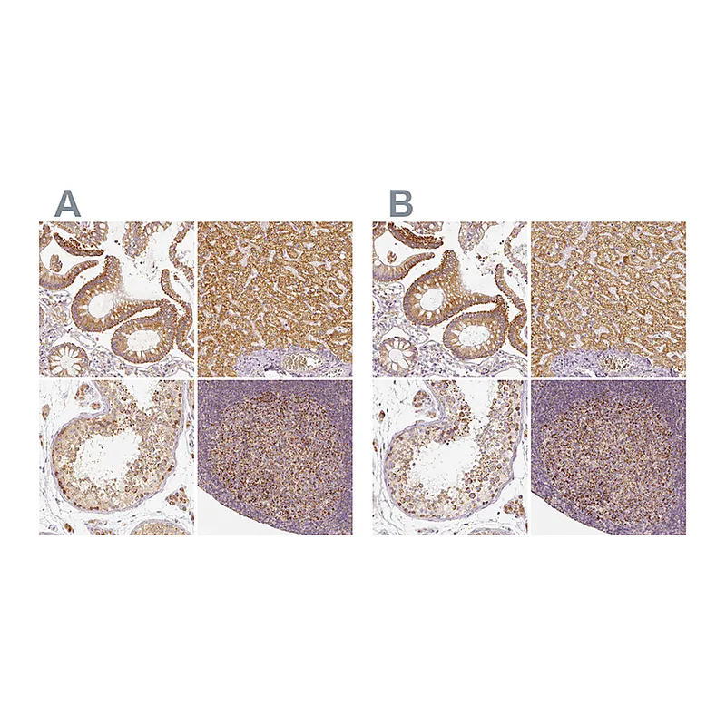 Atlas Antibodies Anti-PGAM5 Antibody