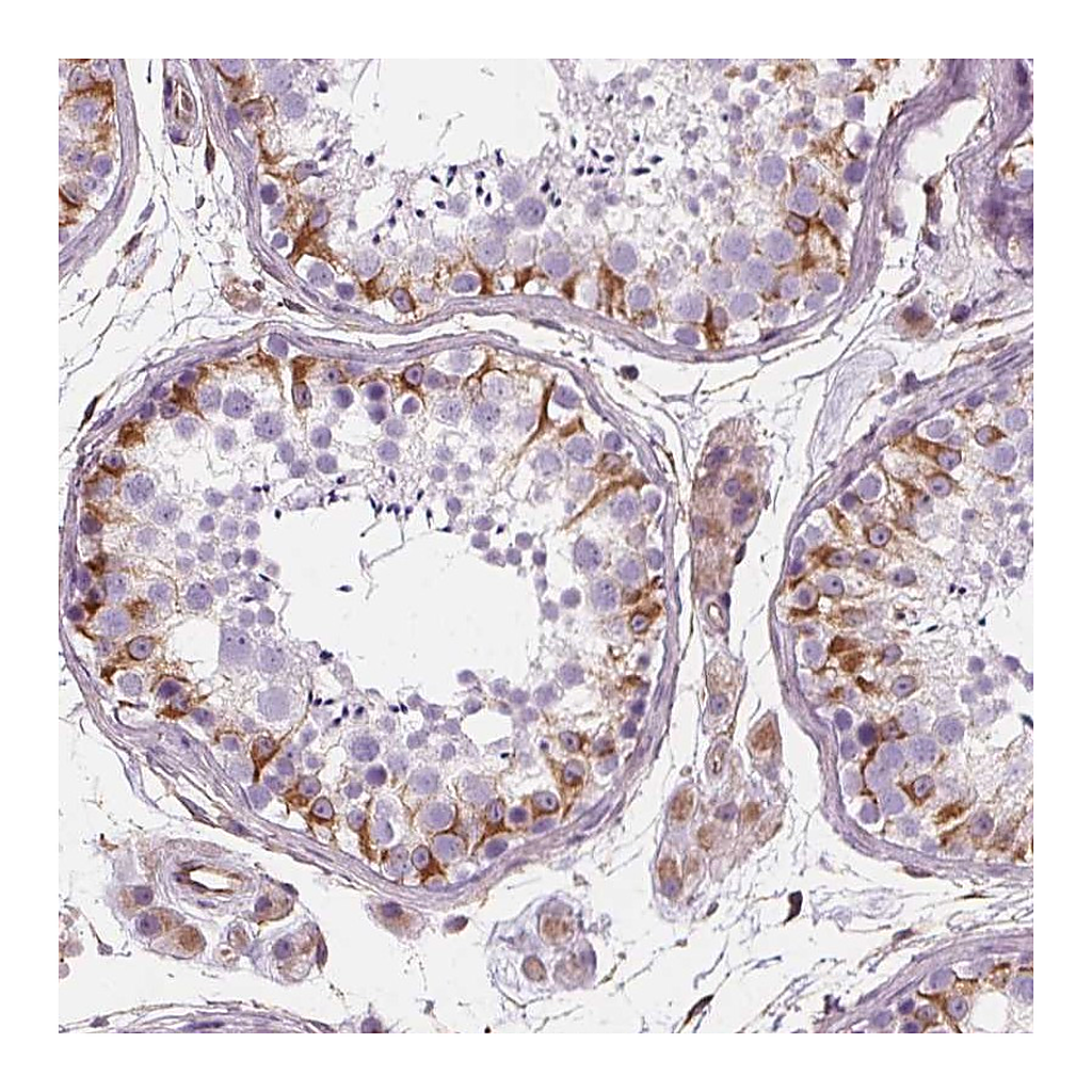 Atlas Antibodies Anti-PGAP1 Antibody