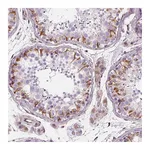 Atlas Antibodies Anti-PGAP1 Antibody