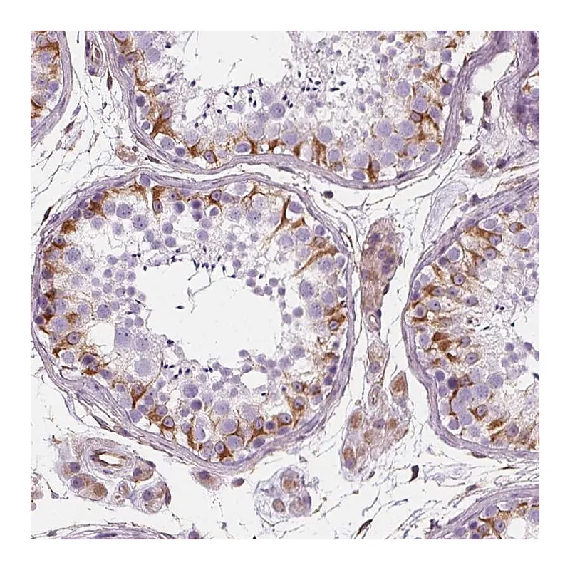 Atlas Antibodies Anti-PGAP1 Antibody