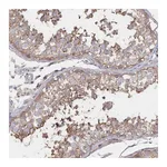 Atlas Antibodies Anti-PGAP2 Antibody
