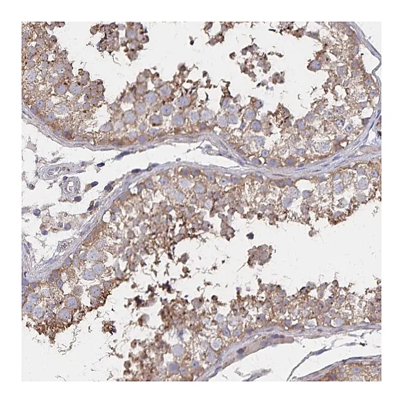 Atlas Antibodies Anti-PGAP2 Antibody