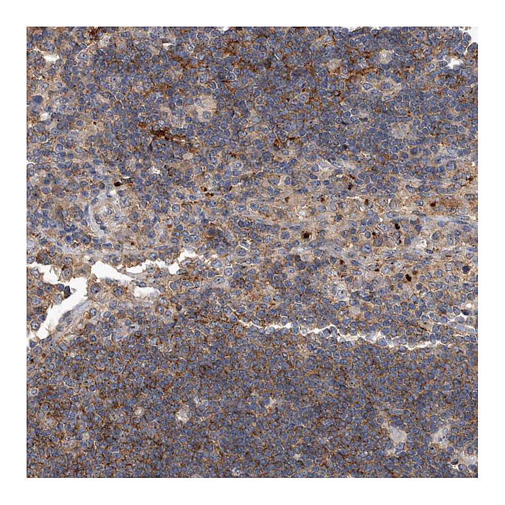 Atlas Antibodies Anti-PGBD2 Antibody