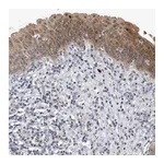 Atlas Antibodies Anti-PGBD2 Antibody
