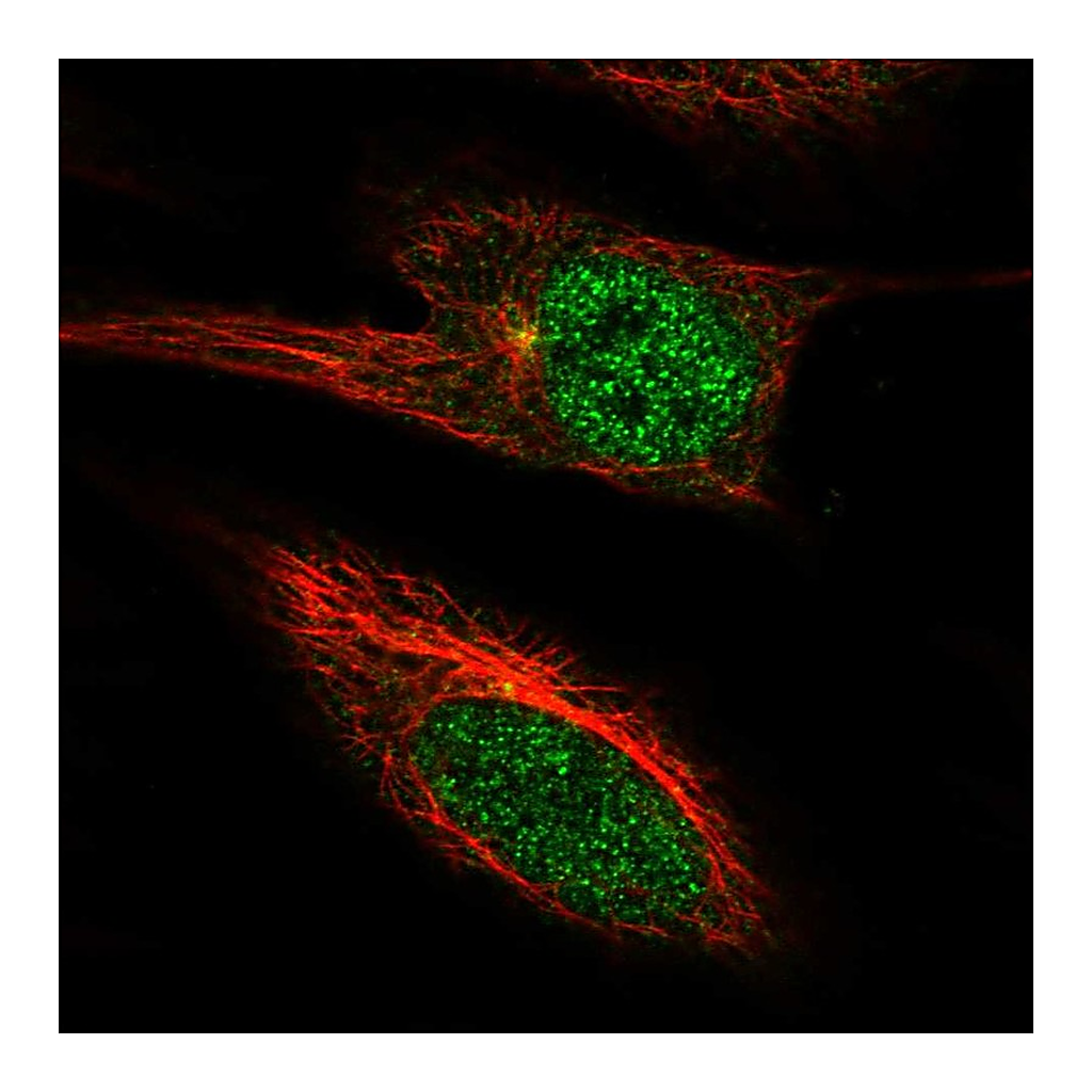 Atlas Antibodies Anti-PGBD4 Antibody