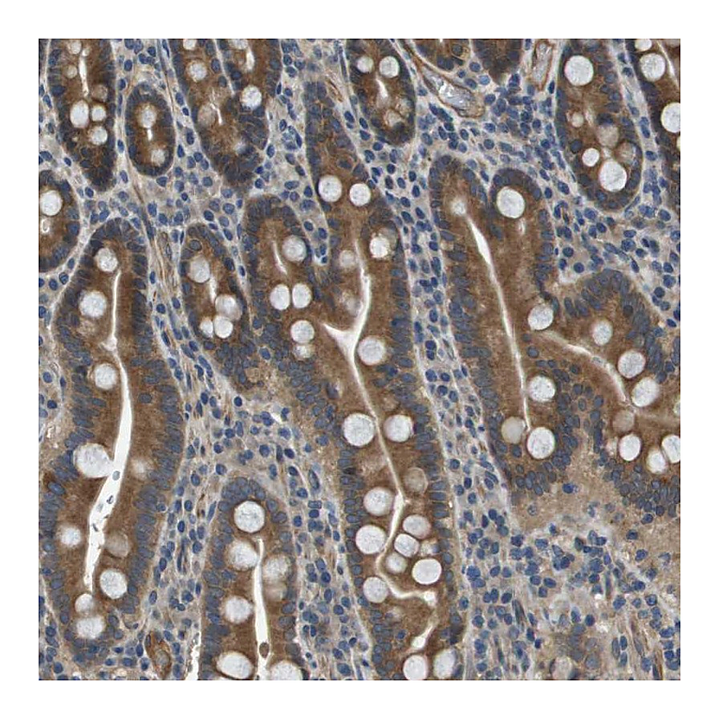 Atlas Antibodies Anti-PGAP3 Antibody