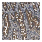 Atlas Antibodies Anti-PGAP3 Antibody
