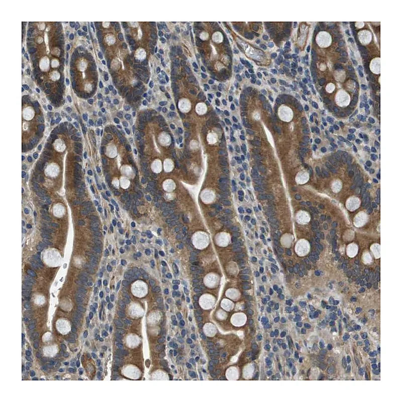 Atlas Antibodies Anti-PGAP3 Antibody