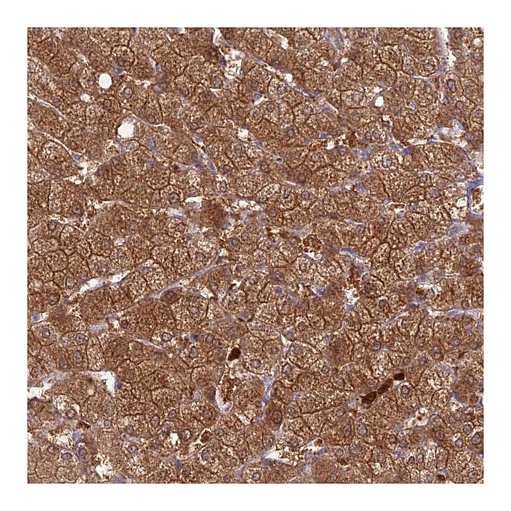 Atlas Antibodies Anti-PGBD4 Antibody