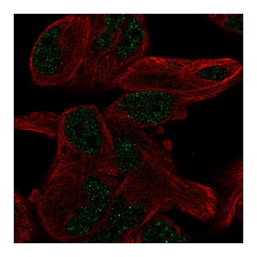 Atlas Antibodies Anti-PGBD5 Antibody