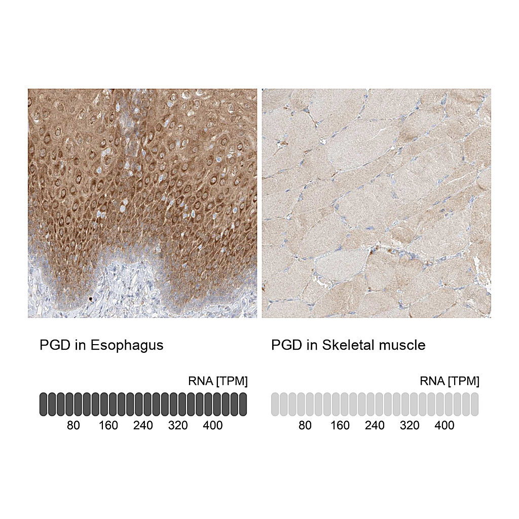 Atlas Antibodies Anti-PGD Antibody