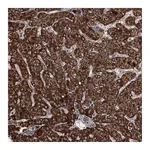Atlas Antibodies Anti-PGGHG Antibody