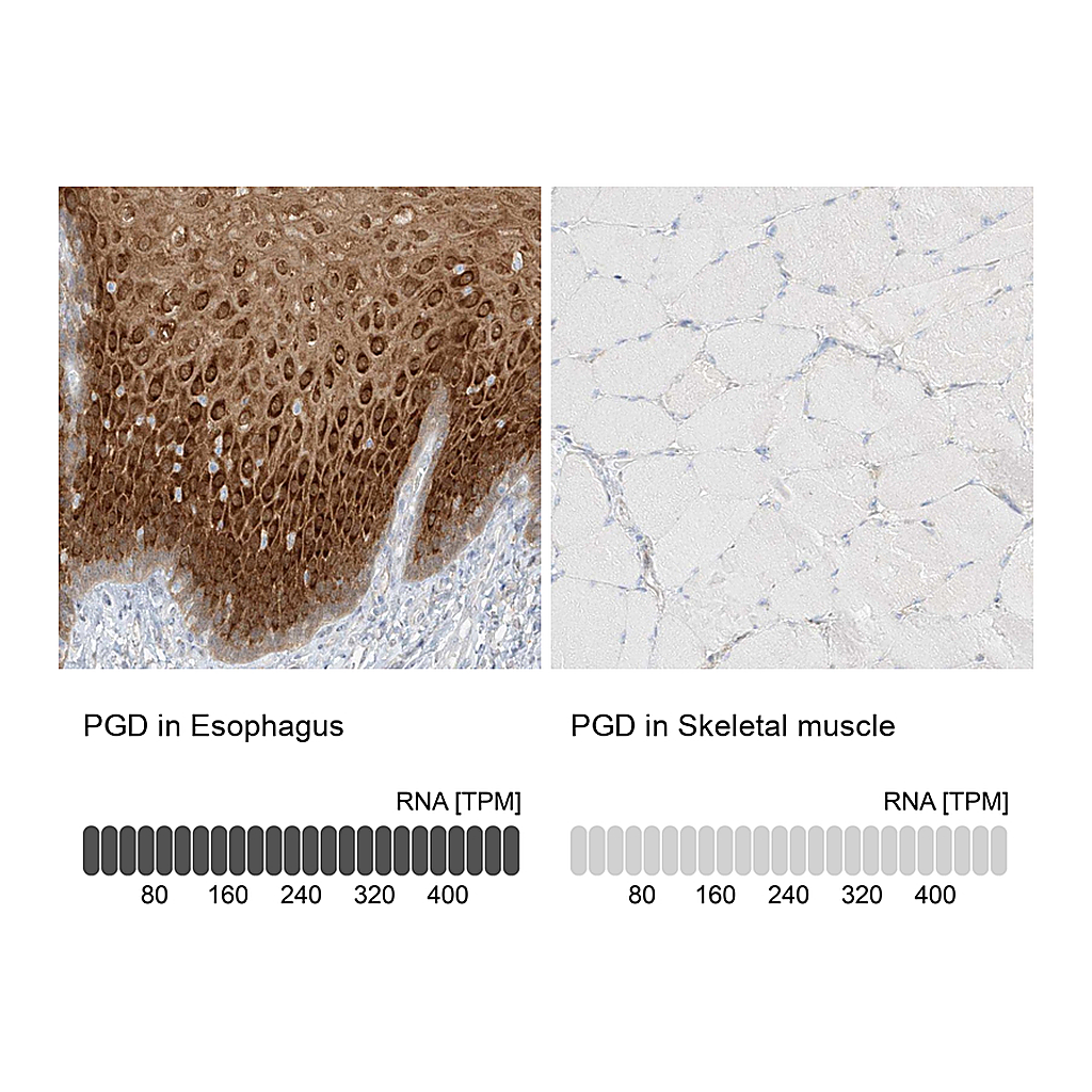 Atlas Antibodies Anti-PGD Antibody
