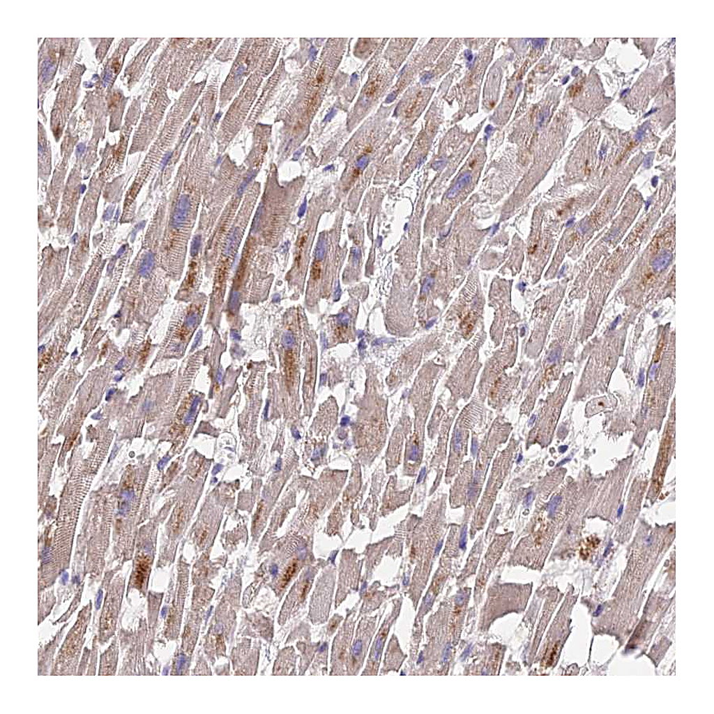 Atlas Antibodies Anti-PGK1 Antibody
