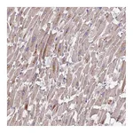 Atlas Antibodies Anti-PGK1 Antibody