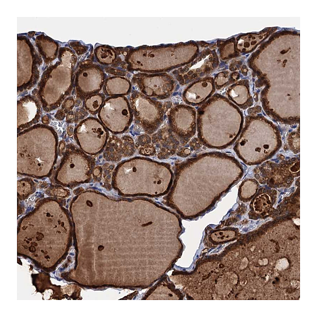 Atlas Antibodies Anti-PGLS Antibody