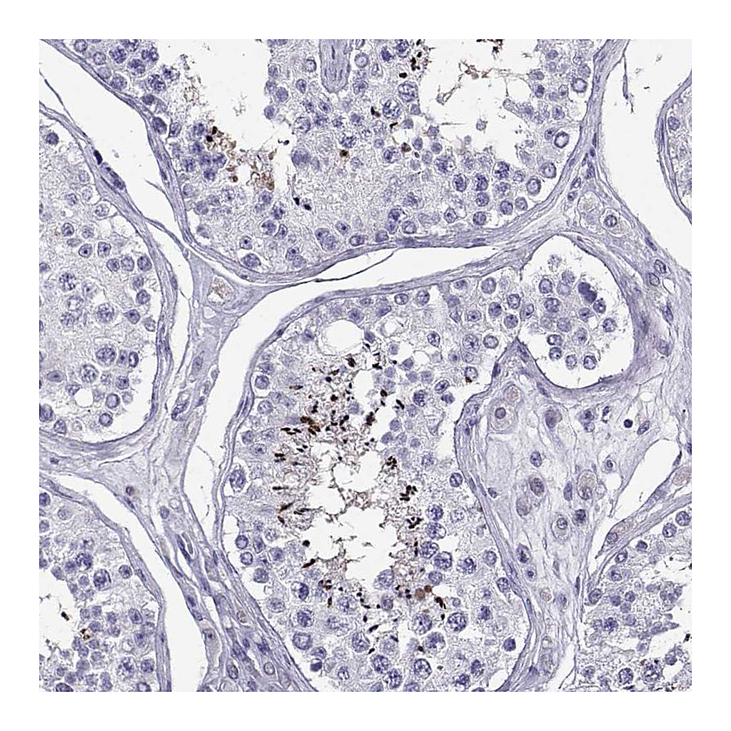 Atlas Antibodies Anti-PGK2 Antibody