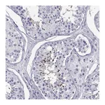Atlas Antibodies Anti-PGK2 Antibody