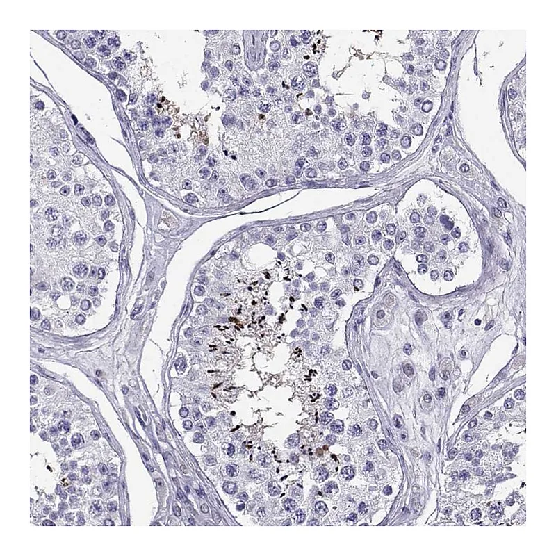 Atlas Antibodies Anti-PGK2 Antibody