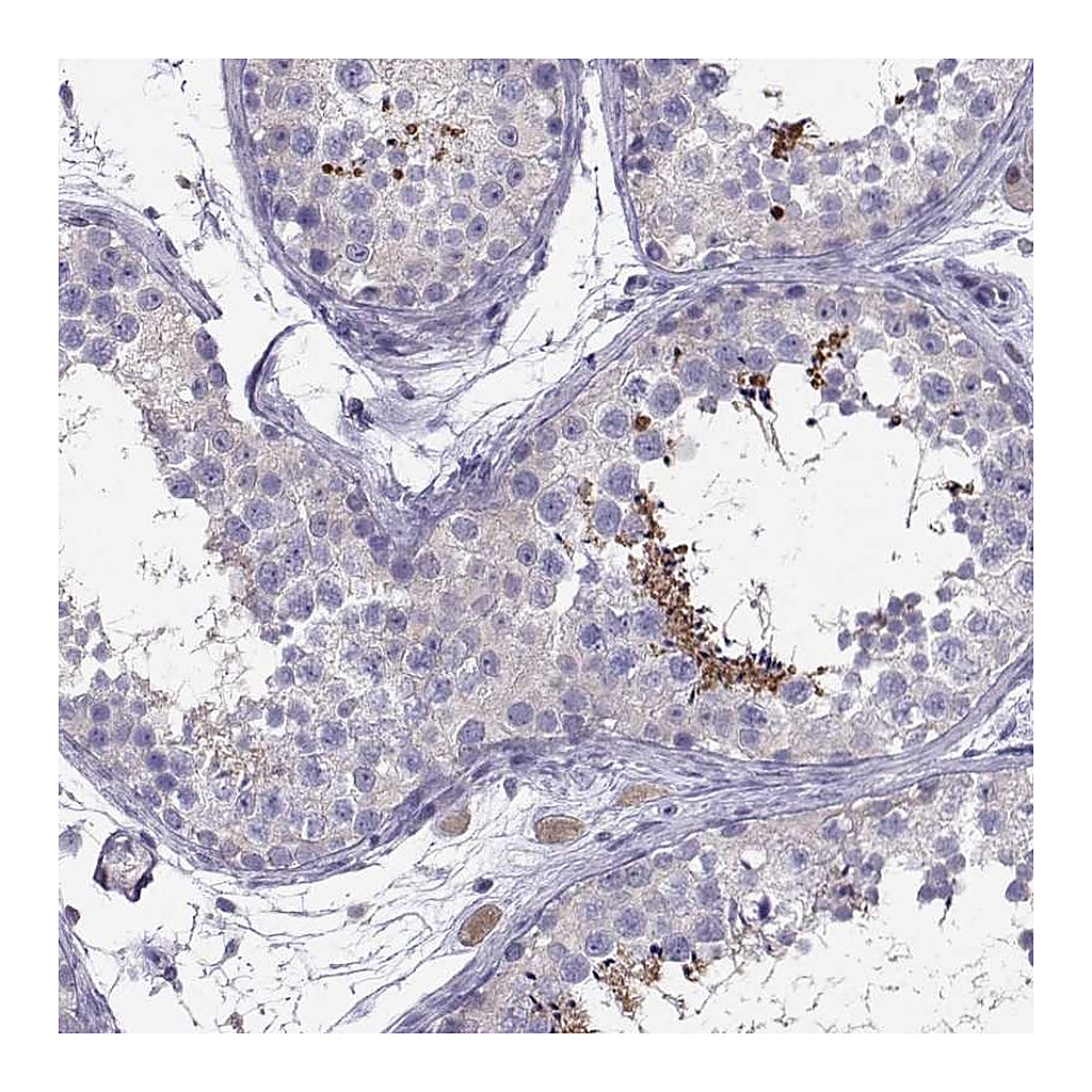 Atlas Antibodies Anti-PGK2 Antibody
